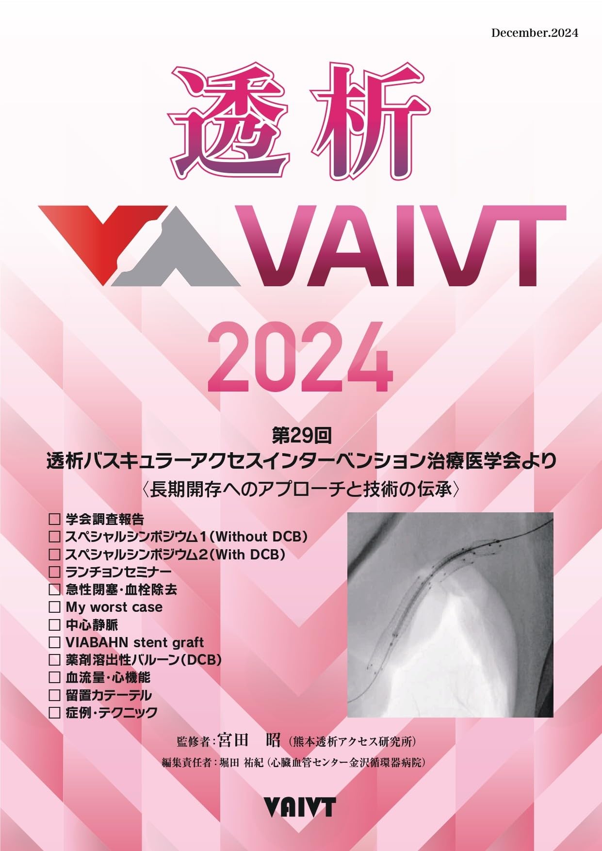 透析VAIVT2024 | 株式会社アクセス・ケイ |本 | 通販 | Amazon